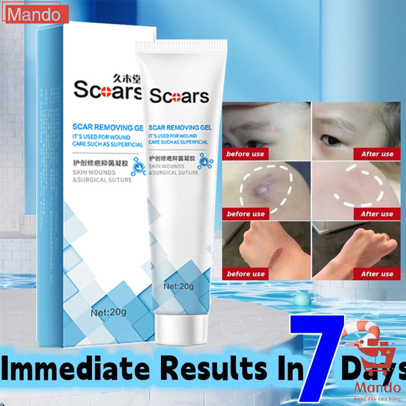 Gel ngừa mụn giảm mụn dưỡng da mờ sẹo an toàn hiệu quả nhanh 20g