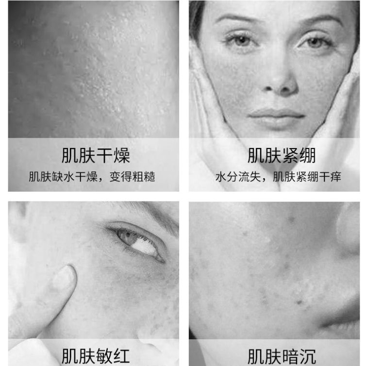 (Hộp 5 cái) Mặt nạ lụa Niacinamide SEOMOU giảm mụn giảm thâm sáng da, kiểm soát dầu, se khít lỗ chân lông A183