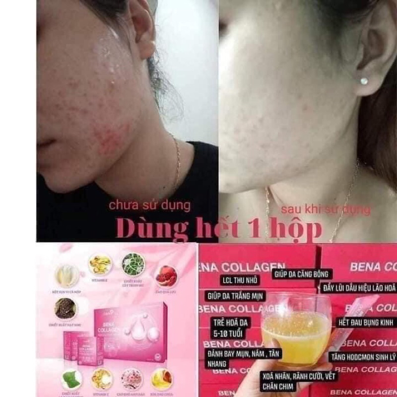 Hộp 15gói Bena collagen  - giúp chống lại quá trình lão hoá, giá da trắng- căng bóng