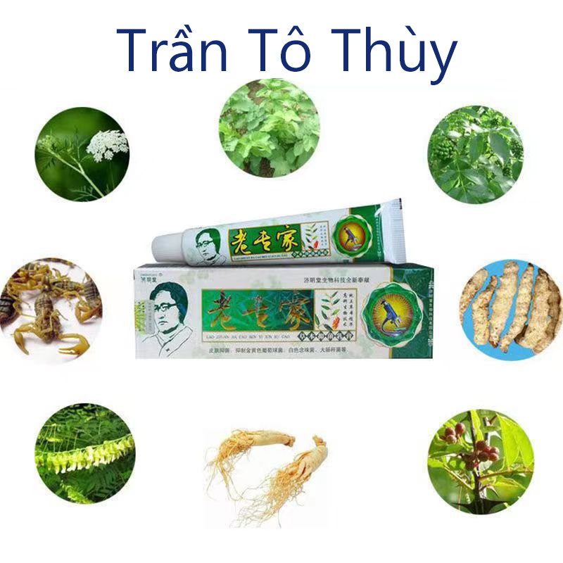 Kem bôi nấm ngứa tổ đỉa hắc lào lang ben- TrầnTôThùy1 jkvdndbvj ad