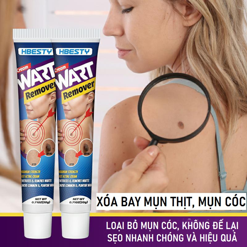 Wart Remover Cream HBESTY 20g Đánh Bay Mụn Ruồi Trâu, Mụn Thịt, Mụn Cóc, Mụn Cơm Cứng Đầu Nhanh Chóng, Không Để Lại Sẹo