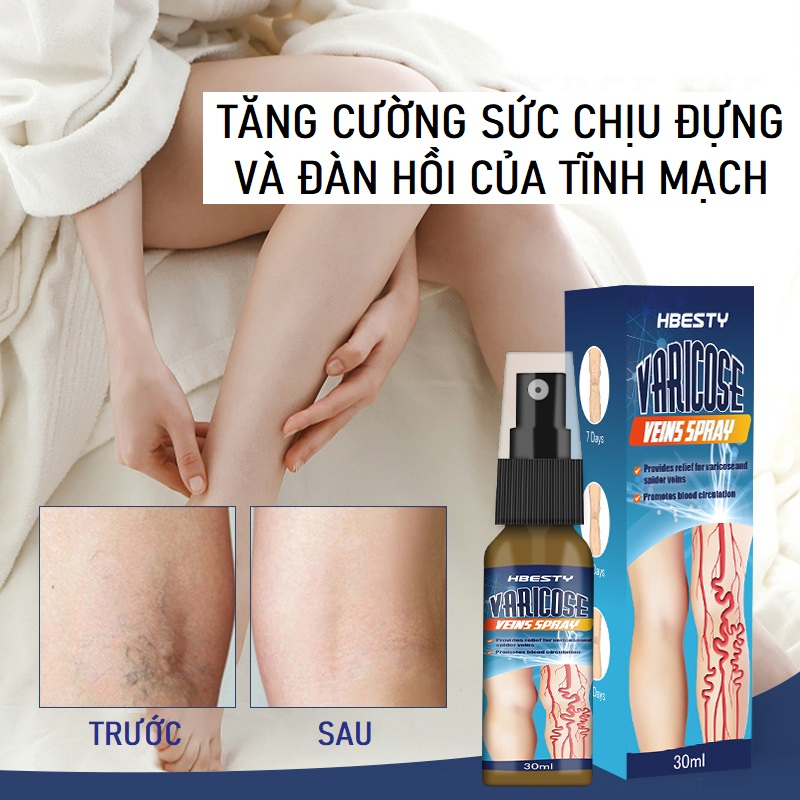 Chai Xịt Ngăn Suy Giãn Tĩnh Mạch VARICOSE HBESTY 30ml, Giúp Tan Máu Đông Cải Thiện Hiệu Quả Tình Trạng Giãn Tĩnh Mạch