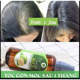 Tinh Dầu Bưởi Mẹ Ken 100ml