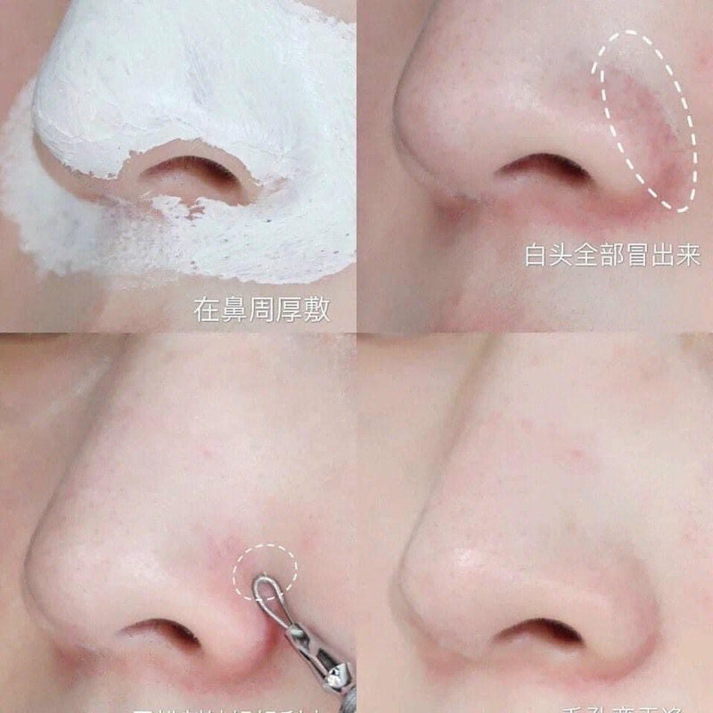 Mặt nạ mask đất sét Kiehl's giúp làm sáng da mờ sẹo thâm do mụn mini 14ml