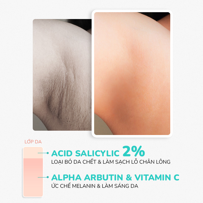 Combo Kem Giảm Thâm Nách, Dưỡng Trắng Da Nách Mông Bikini Khuỷu Tay Đầu Gối Khử Mùi Hôi Nách LA BEAU TÉ 70g