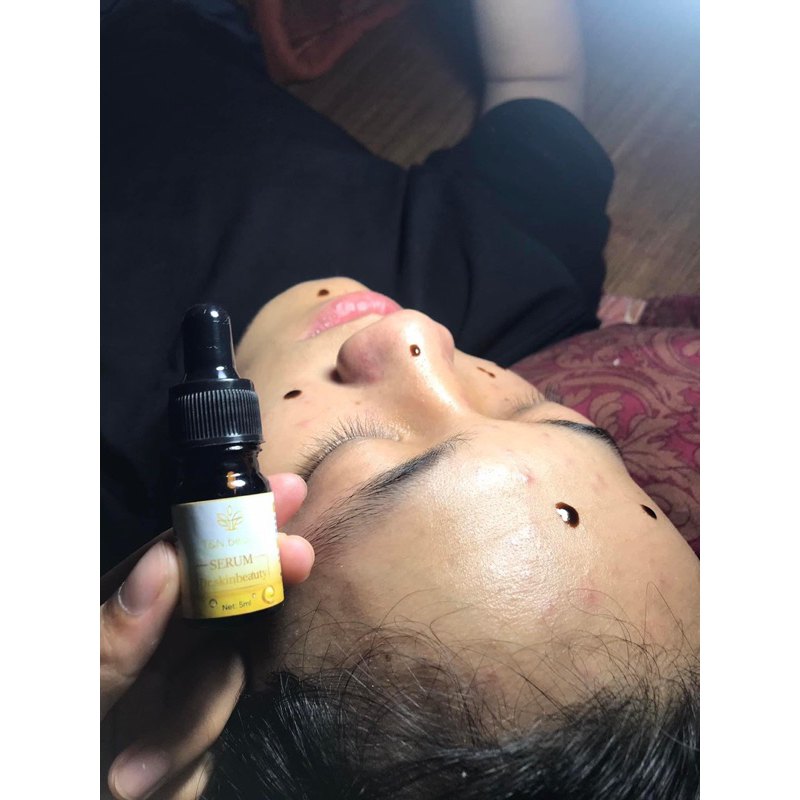 serum mụn skin beauty