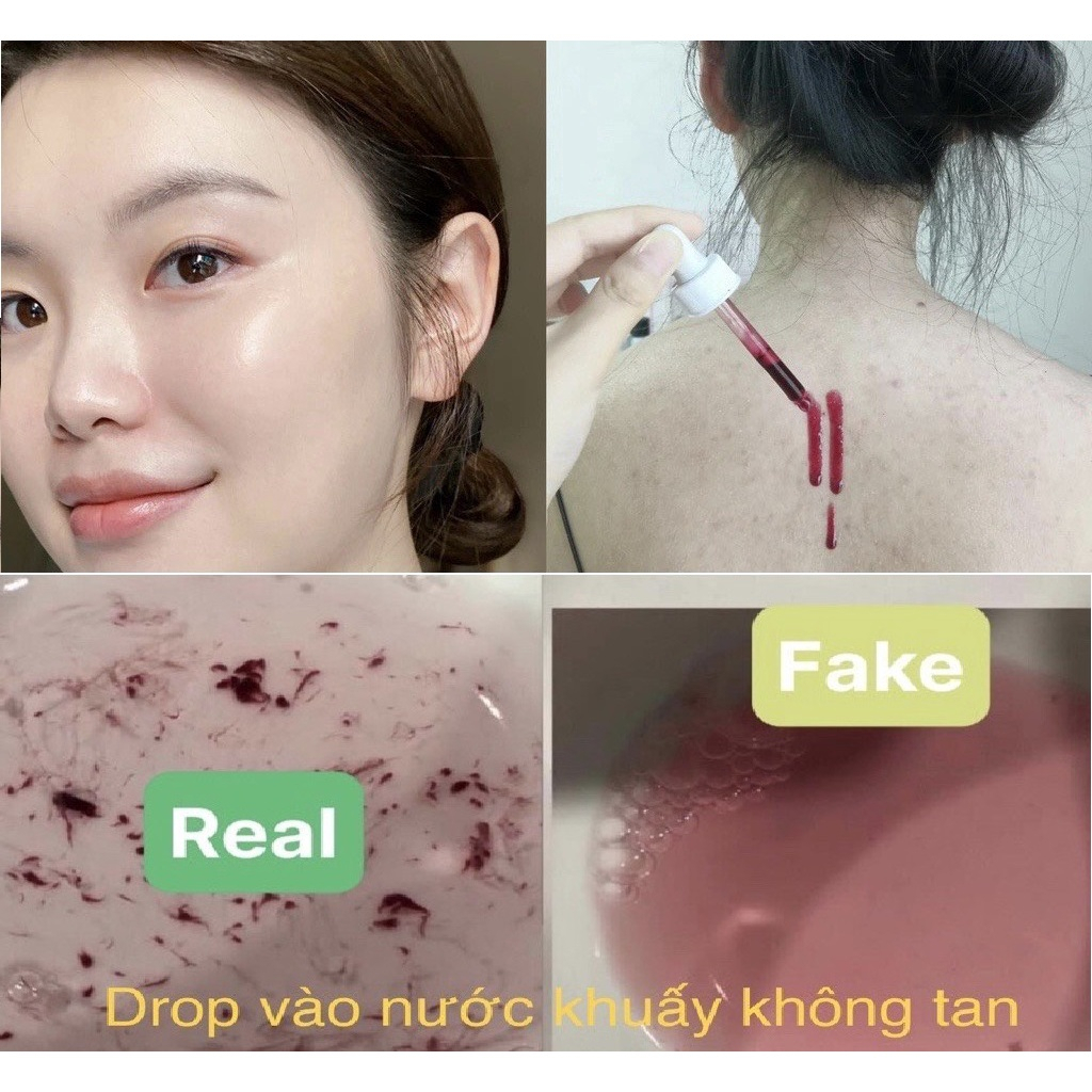 CHÍNH HÃNG✨ The Ordinary AHA 30%+BHA 2% Peeling Solution 30ml Tinh Chất Peel da  Hàn Quốc loại bỏ tế bào chết,trẻ hóa da