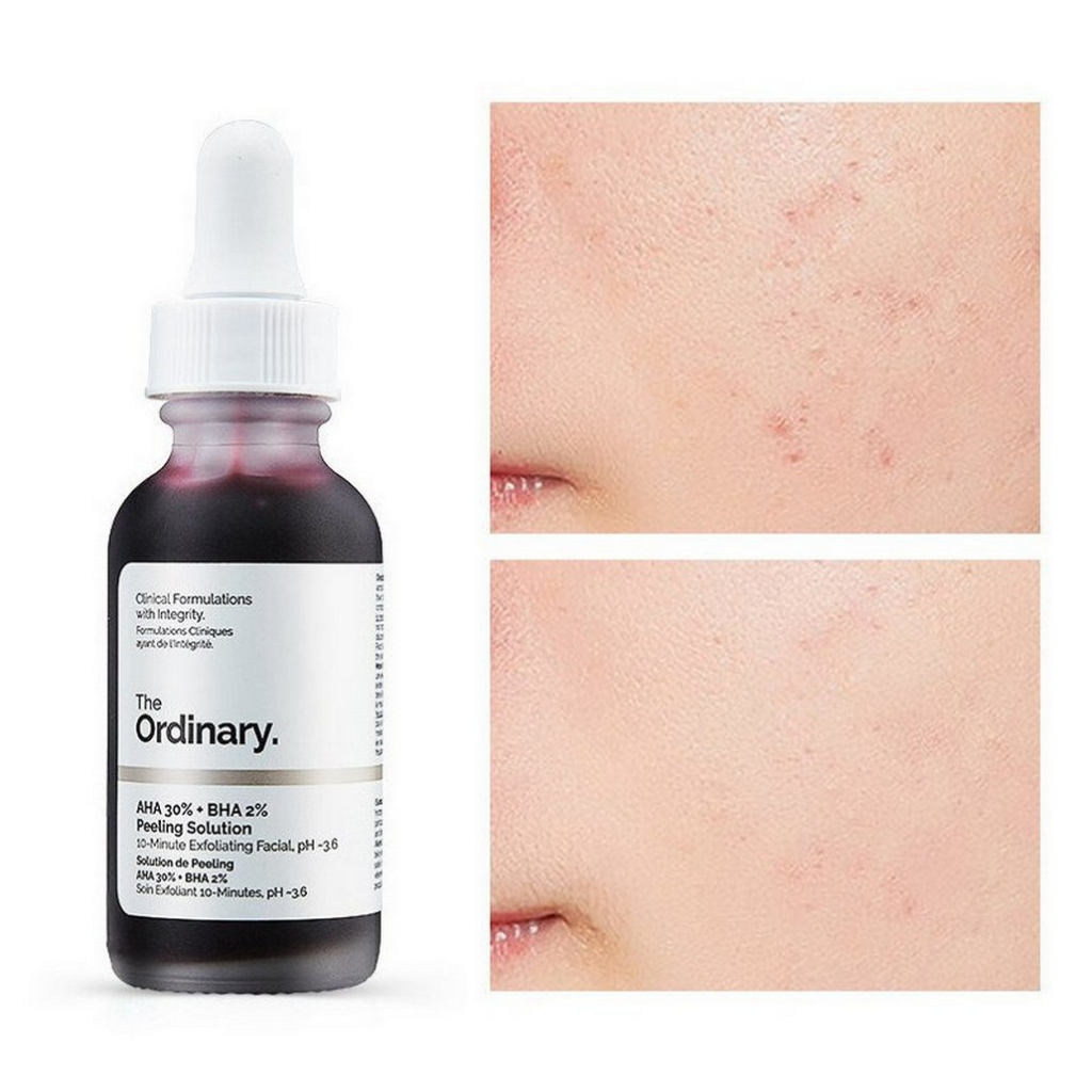 Peel Da ordinary The Ordinary AHA 30% + BHA 2% Peeling Solution 30ml thanh tẩy da Peel da Tẩy da chết hóa học