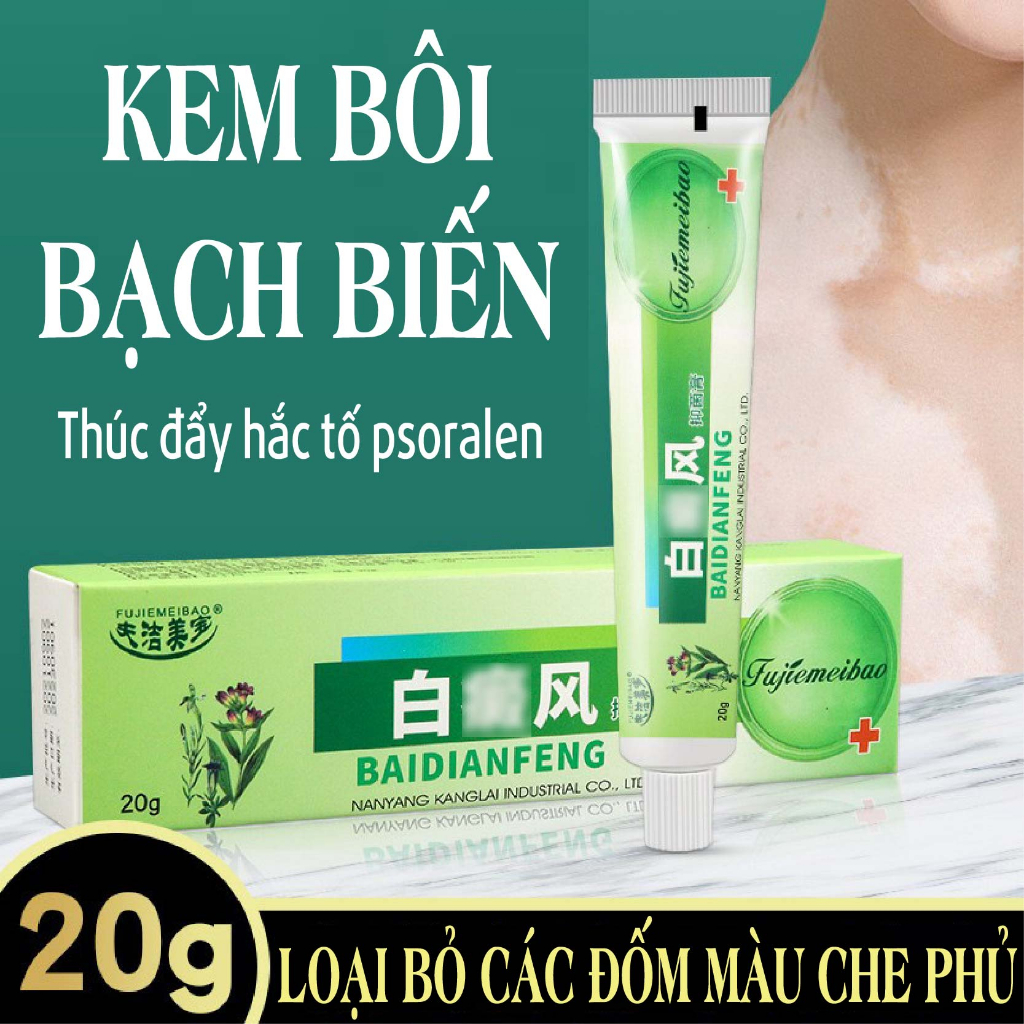 Kem bôi bạch biến cực hiệu quả