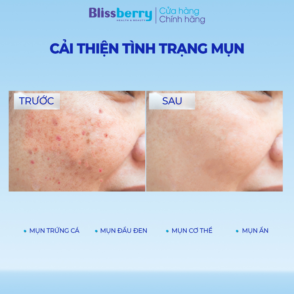 Gel giảm mụn mờ thâm Blissberry Pureskin Acne Fixer K21 15ml