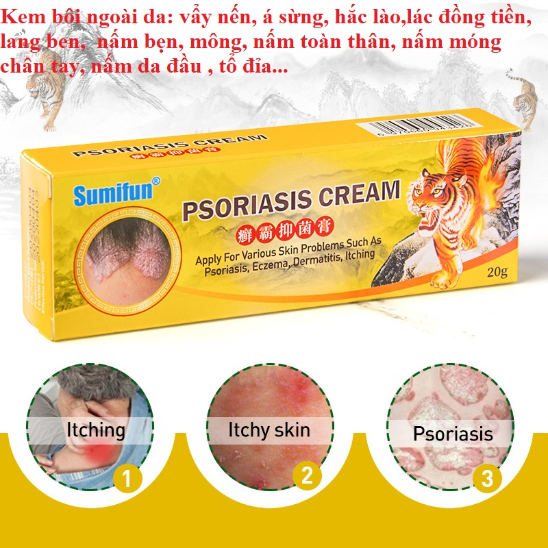 Kem Da Liễu, bôi Nấm Da Đầu, Vảy Nến, Á Sừng, Hắc Lào, Lang Ben, thành phần thảo dược tự nhiên, 100% Herbal