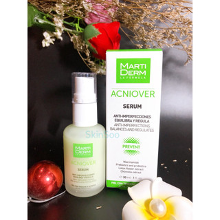 [TEM CÔNG TY] Tinh Chất Giảm Mụn, Kiểm Soát Nhờn Martiderm Acniover Serum