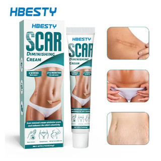 Kem xóa sẹo Scar Diminising Cream HBESTY, loại bỏ vết rạn da, các loại sẹo lồi, sẹo phẫu thuật , sẹo bỏng