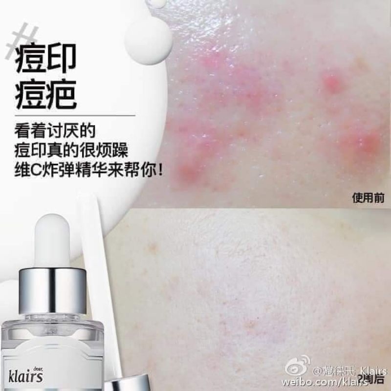 Serum Klairs Vitamin C 35ml