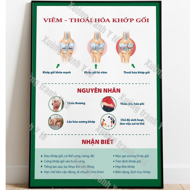 (Decal Dán) Tranh Xương Khớp: Viêm - Thoát Hóa Khớp Gối