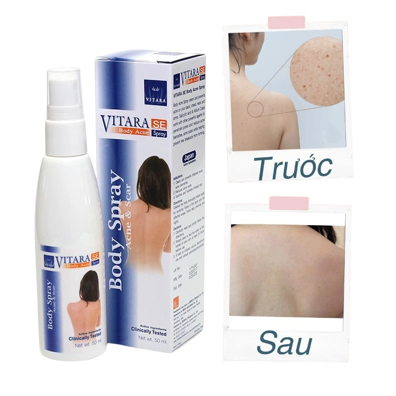 Chai Xịt Mụn Lưng, Cánh Tay, Ngực Và Cổ Thái lan VITARA SE Body Acne Spray 50ml