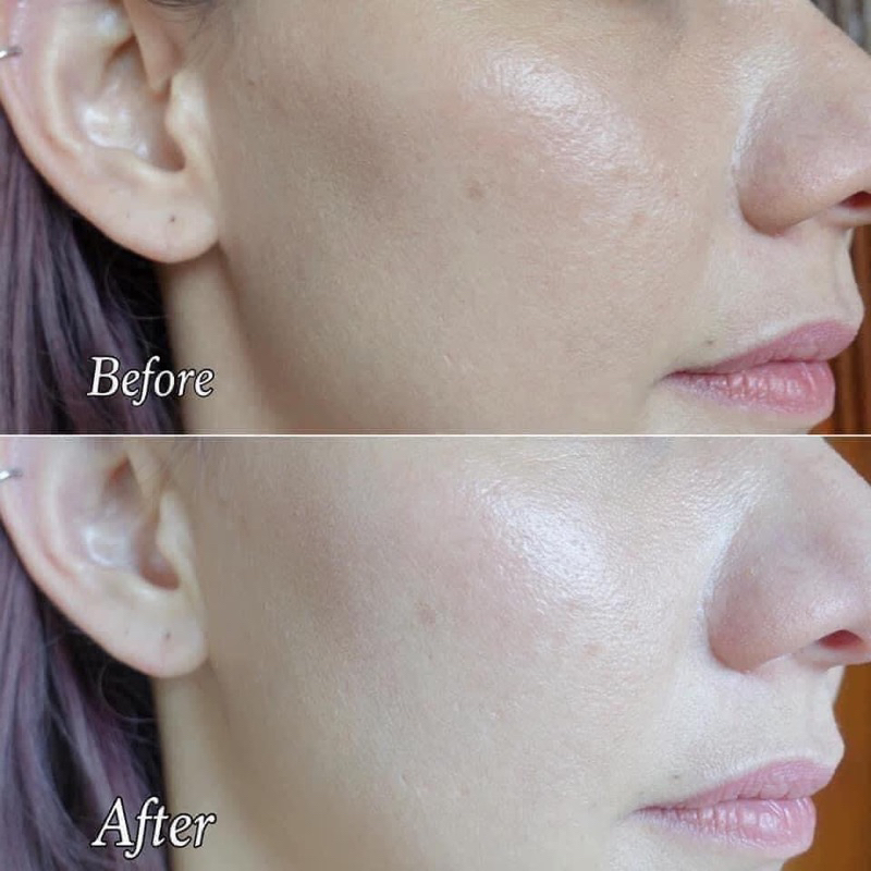 Tinh Chất Sáng Da Vitamin C MURAD Glycolic Brightening 5ml