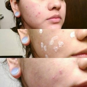 Dung Dịch Chấm Mụn Mario Badescu Drying Lotion 29ml