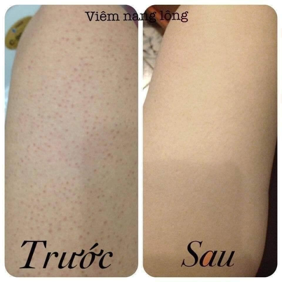 Sữa tắm Aderma Shower Gel Hydra-Protective 500ml