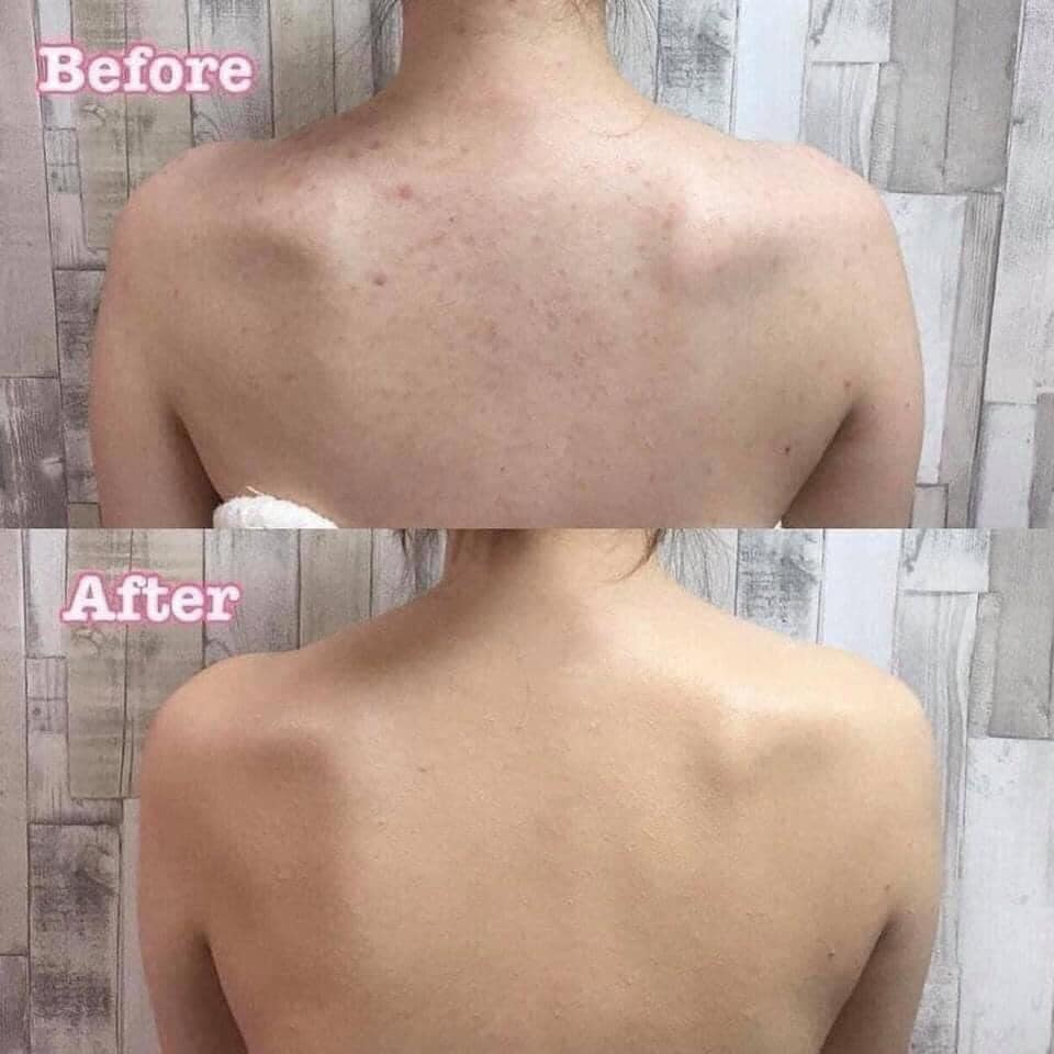 Sữa tắm Aderma Shower Gel Hydra-Protective 500ml