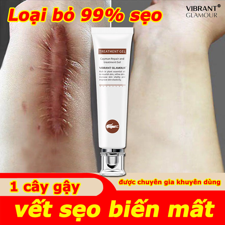 Hiệu quả sau 3 ngày,Kem xóa sẹo Kem sẹo 20g sẹo do bị thương,sẹo bỏng,sẹo phẫu thuật sửa chữa,Sửa Chữa Sẹo Mặt Cơ Thể