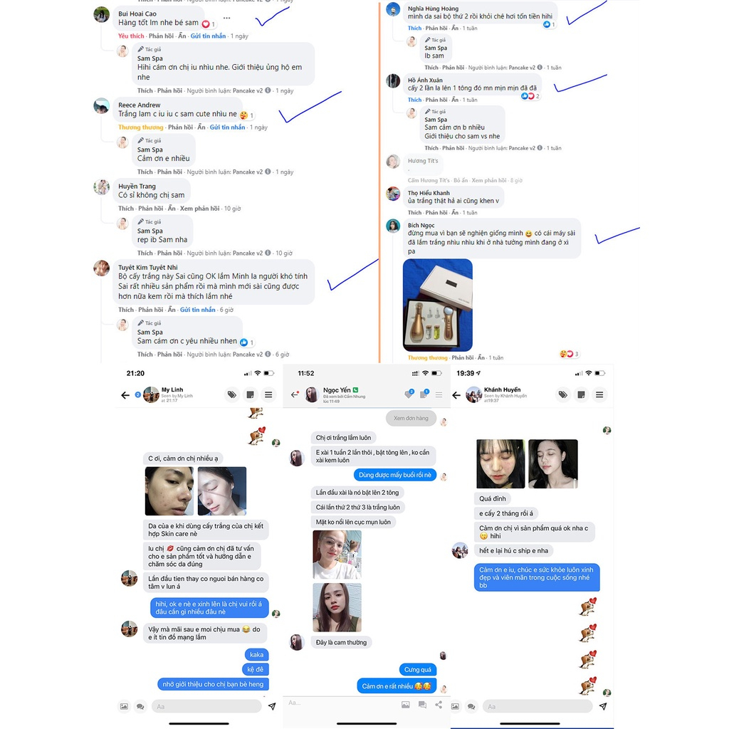 Cấy Trắng Da Mặt Nguyên Bào Sợi Dưỡng Trắng, Căng Bóng, Mờ Nám Tàn Nhang