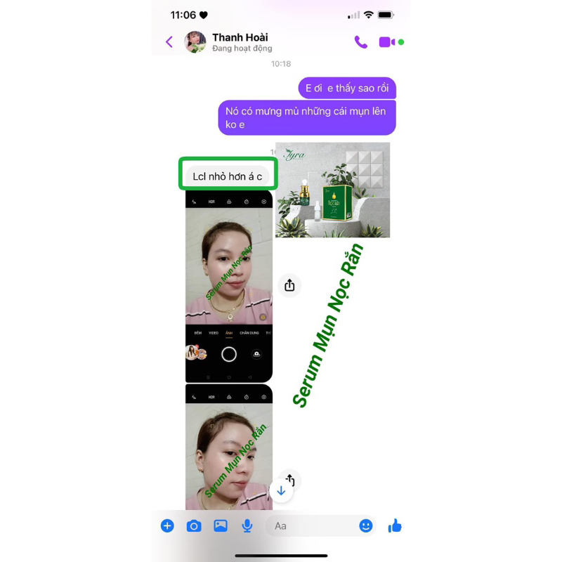 SERUM NỌC RẮN