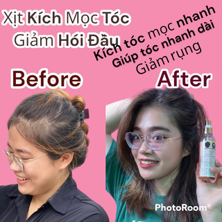 Xịt mọc tóc genive thái lan tặng lăn mọc mày