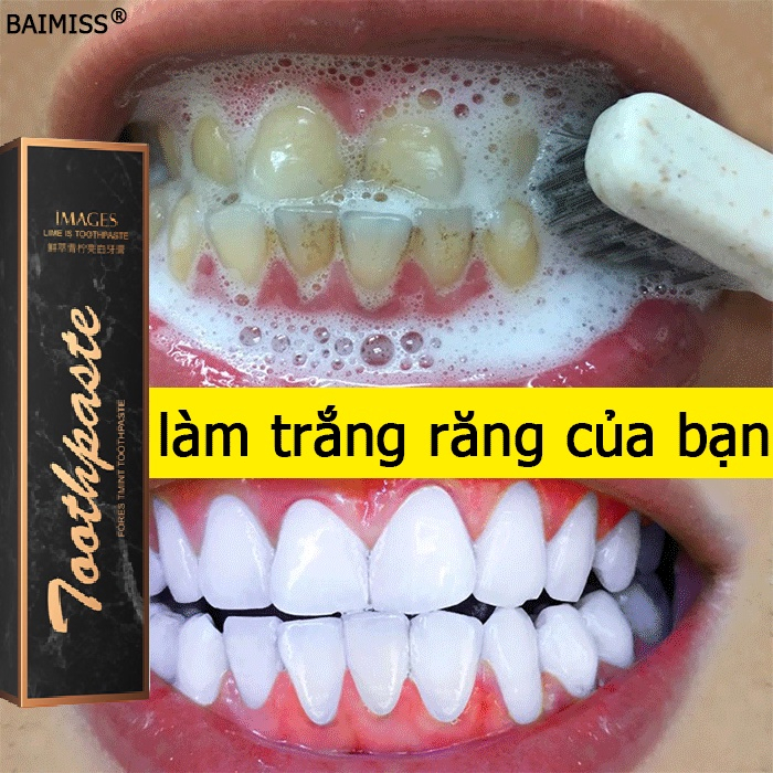 Kem Đánh Răng Làm Trắng Răng Kem đánh trắng răng 85g baking soda xóa cao răng giảm mùi hôi miệng Giảm vi khuẩn