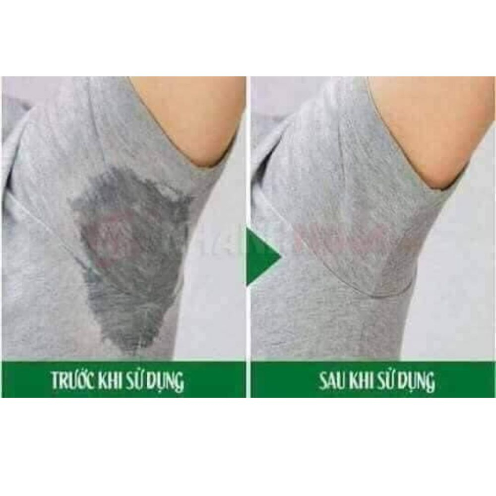 Xịt Loại Bỏ Hôi Nách Hoa Cúc - Ngăn Tiết Mồ Hôi - Sáng Vùng Da Nách