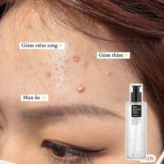 BHA blackhead giảm mụn đầu đen