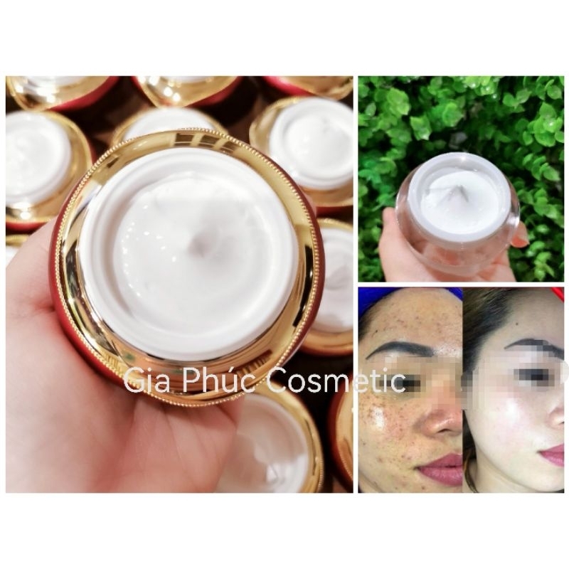 Kem Face Tăng Sinh Collagen ¦ Mờ Thâm Nám ¦ Căng Bóng Da
