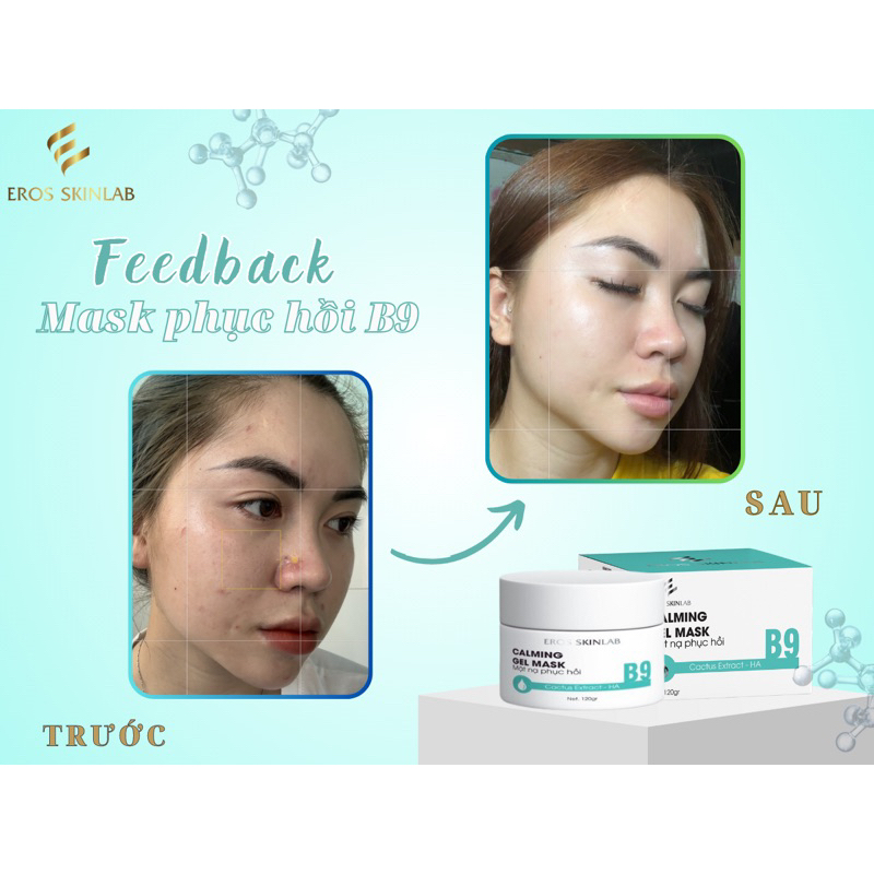 Mặt Nạ B9 EROS SKINLAB