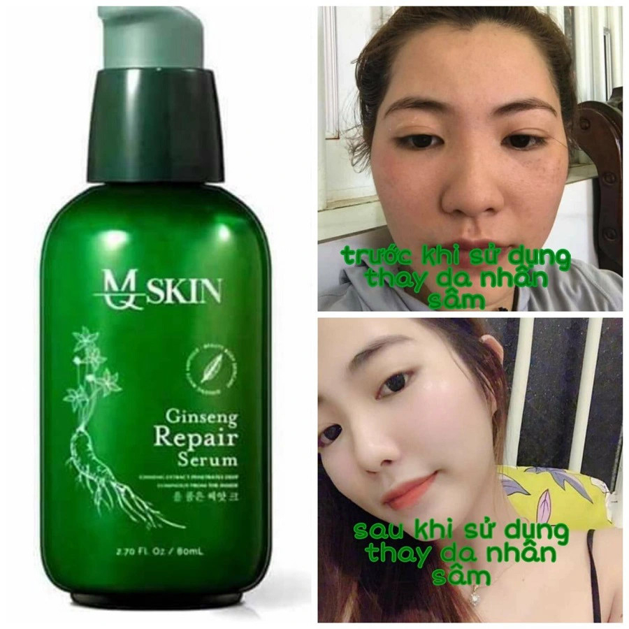 Serum Thay Da Nhân Sâm MQ Skin Chính Hãng - 100ml