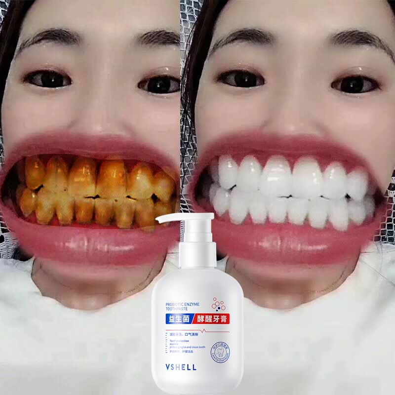 Kem Đánh Răng Làm Trắng Răng Kem đánh làm răng 250g Giảm Vết Ố Vàng Trên Răng Giữ Hơi Thở Thơm Mát Chất Lượng Cao