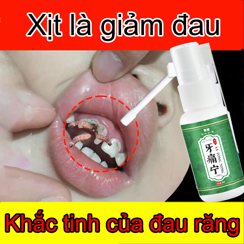 Chai xịt sâu răng Xịt Chống Sâu Răng Chai xịt miệng 30ml Giảm Đau Răng,Ê Buốt,Ngăn Ngừa Sâu Răng Và Làm Thơm Miệng