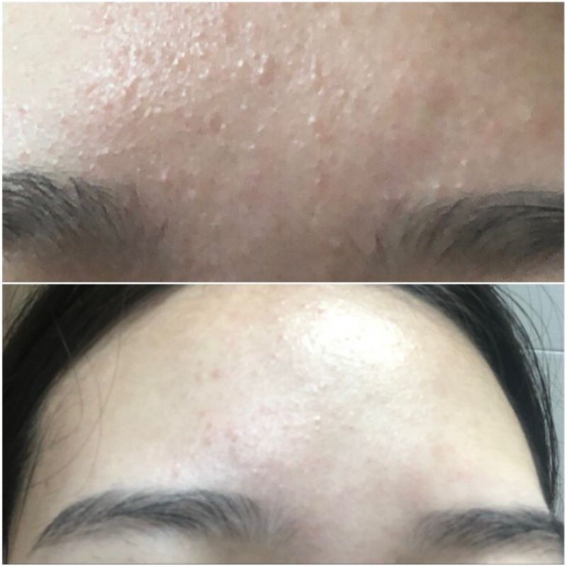 Toner Anua chiết xuất diếp cá làm dịu, dưỡng da  Anua Heartleaf 77% Soothing Toner