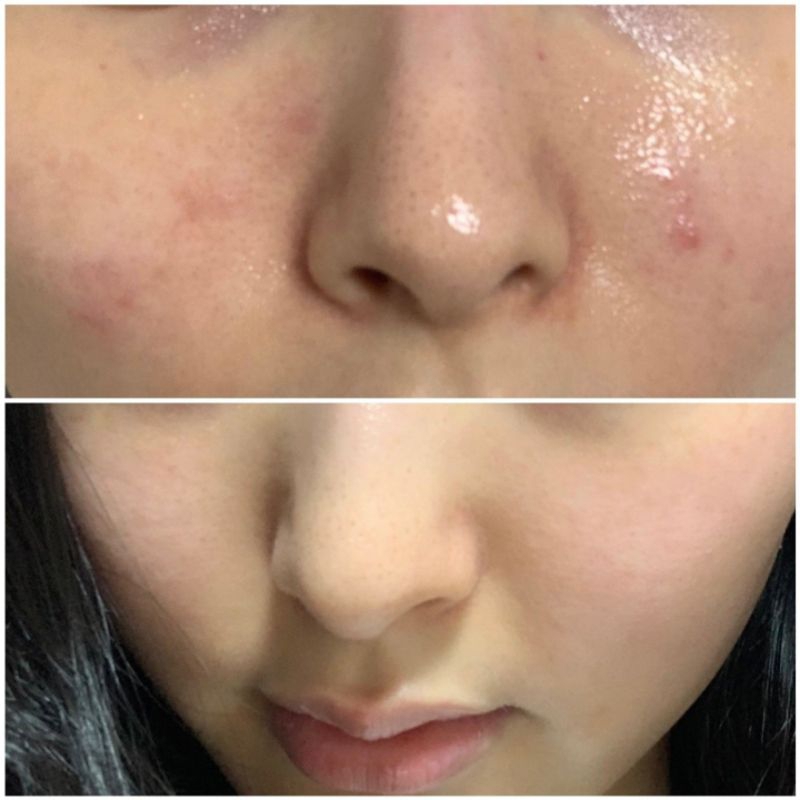 Toner Anua chiết xuất diếp cá làm dịu, dưỡng da  Anua Heartleaf 77% Soothing Toner