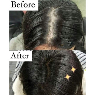 Dầu gội đầu giảm rụng tóc KLORANE