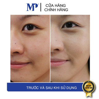 Tế Bào Gốc EGF Luverio Thủy Kim (Epidermal Growth Factor)