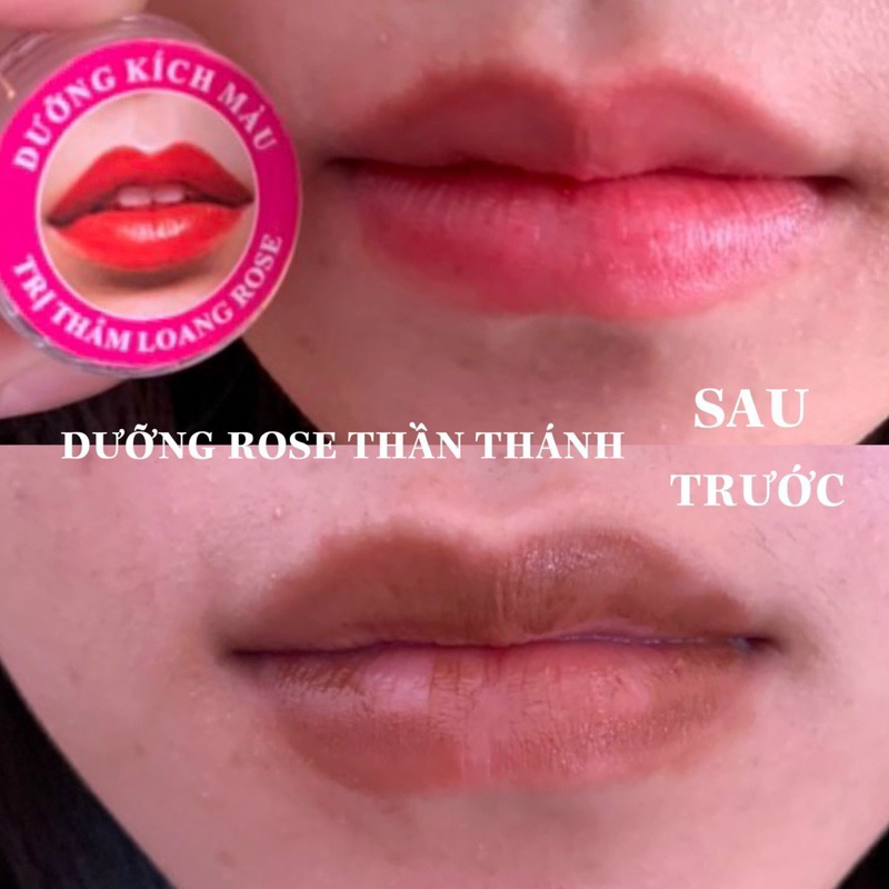 Dưỡng ROSE kích màu, chống thâm 10g