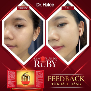 KEM DƯỠNG TRẮNG HỒNG DA RUBY LỰU ĐỎ DR HALEE.
