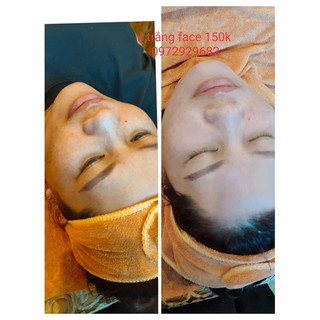 Kem dưỡng trắng thảo dược