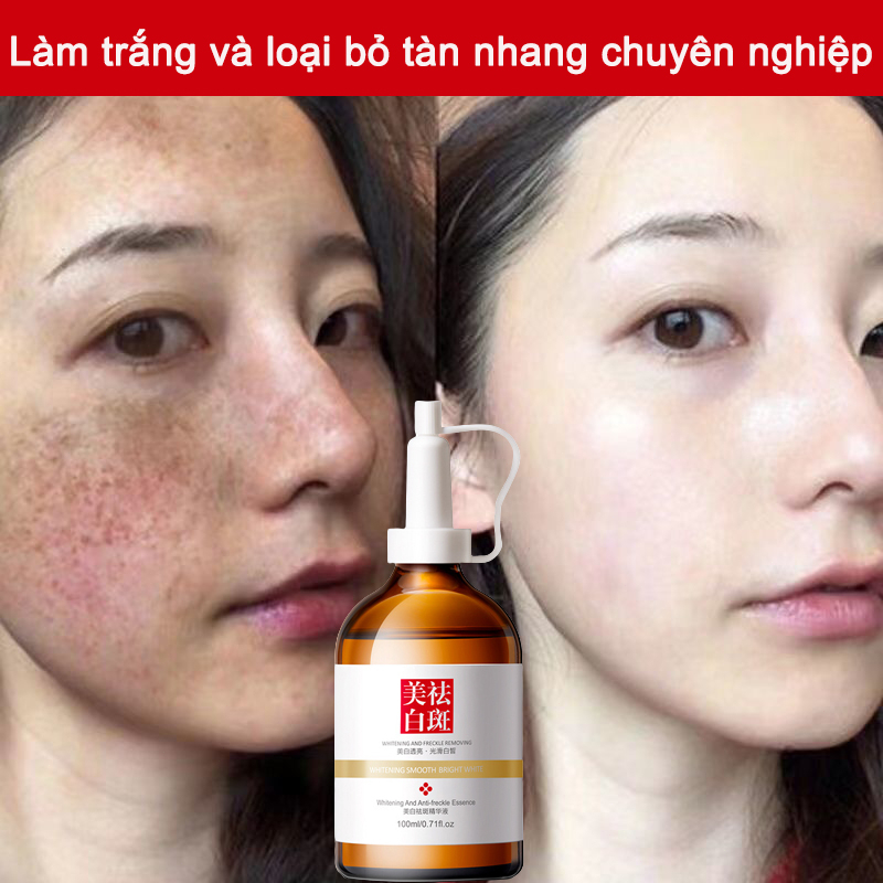 Serum trắng da kem nám tàn nhang chăm sóc da mặt 100ml loại bỏ nám làm sáng tông màu da làm trắng hiệu quả