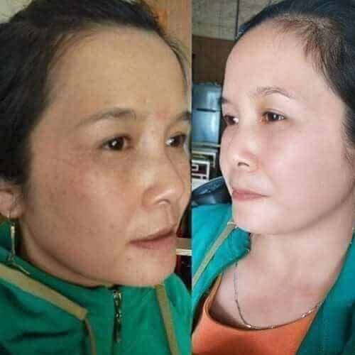 Tàn nhang Berry plus mờ nám tàn nhang đ𝐨̂̀𝐢 𝐦𝐨̂̀𝐢 dưỡng ẩm da phục hồi da chống lão hóa dưỡng da trắng sáng đều màu | BigBuy360 - bigbuy360.vn