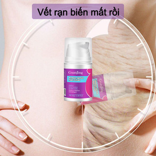 Kem rạn da (Xóa rạn da nhanh chóng trong 7 ngày)Kem xoá rạn da sau sinh làm mờ vết thâm tăng độ đàn hồi cho da làm trắng