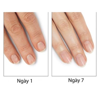 Dưỡng móng + phục hồi hư tổn CND