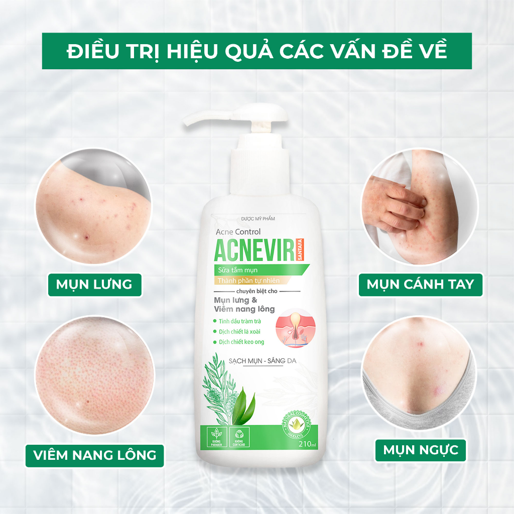 Sữa Tắm Hỗ Trợ Giảm Mụn Giảm Viêm Chân Lông Acnevir Santafa Chai 210ml | BigBuy360 - bigbuy360.vn