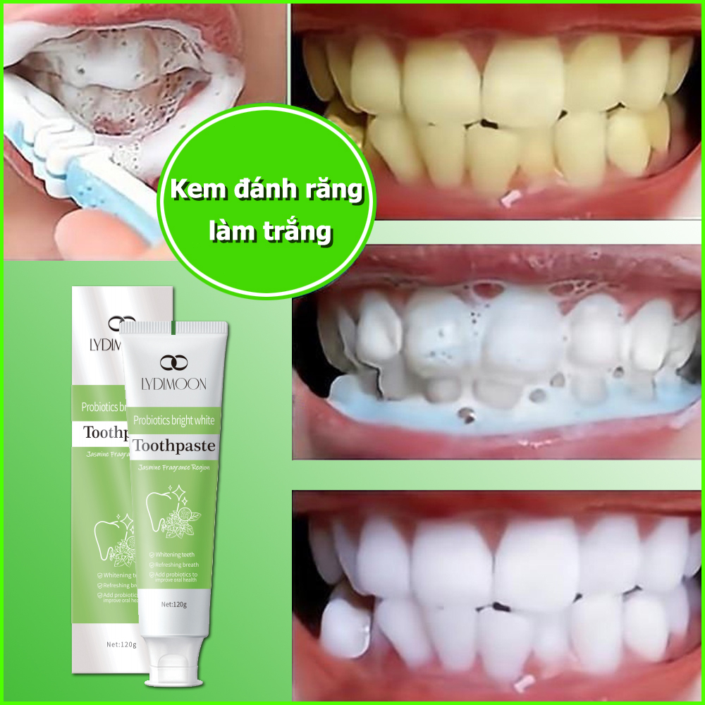 Kem Đánh Răng Làm Trắng Răng Kem đánh trắng răng 120g Giảm Vết Ố Vàng Trên Răng giảm sâu răng Giữ Hơi Thở Thơm Mát
