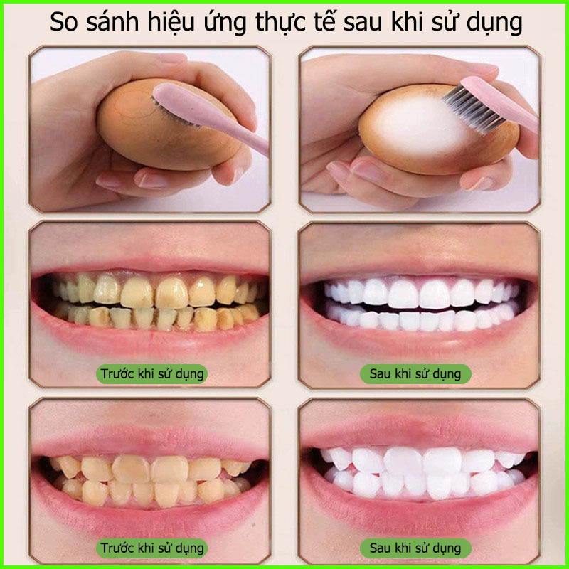 Kem Đánh Răng Làm Trắng Răng Kem đánh trắng răng 120g Giảm Vết Ố Vàng Trên Răng giảm sâu răng Giữ Hơi Thở Thơm Mát